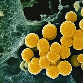 Staphylococcus aureus bacteremia management (Review)