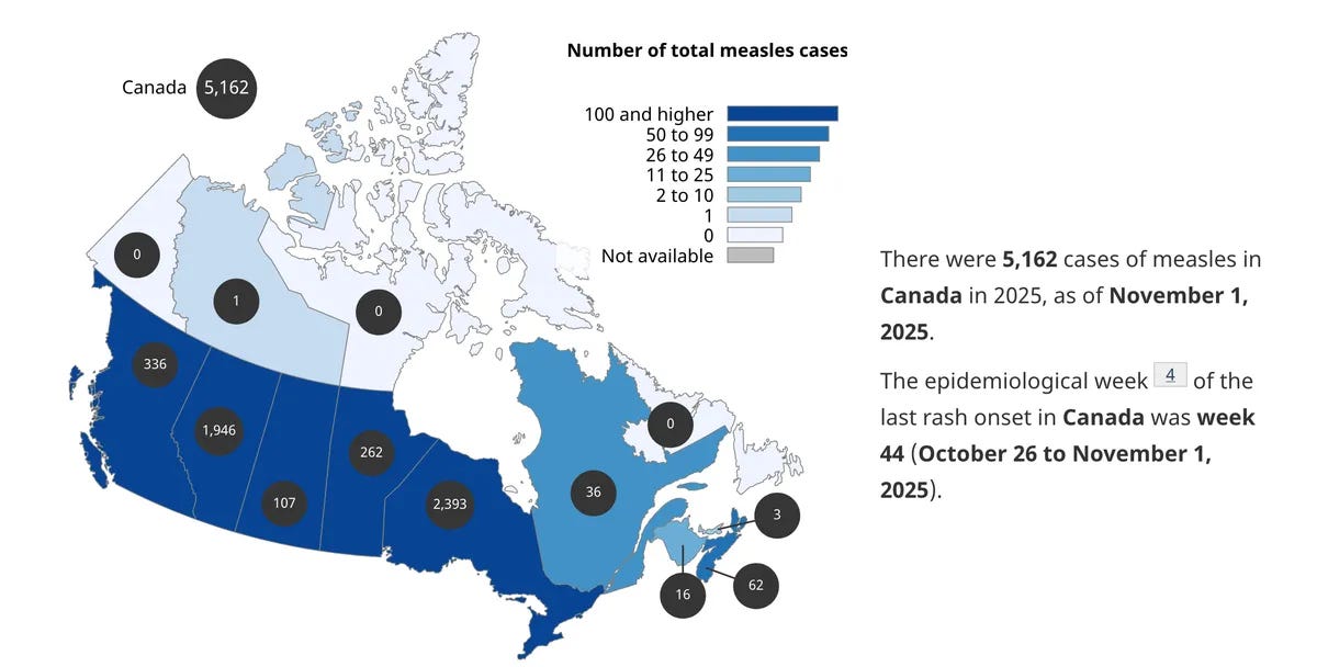 measles-canada measles-canada