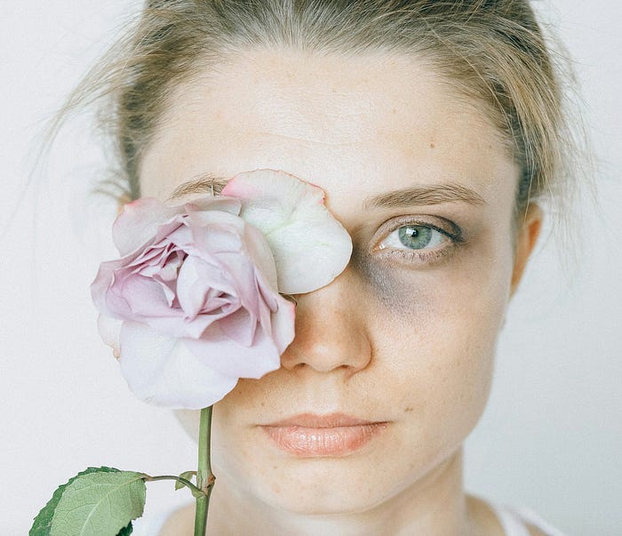 I Gave My Consent. He Gave Me Bruises.