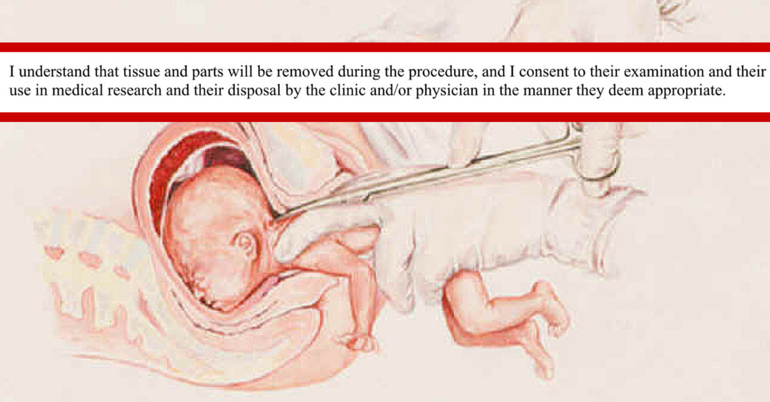 Don't be upset - it's NOT a 'baby'.