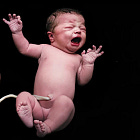 Pathologist Receives Inflamed CALCIFIED Placentas from 'Vaccinated' Women Full of Spike Protein and Antibodies