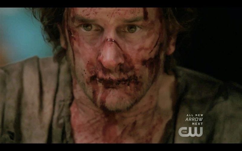 sam winchester removing stitches from gabriels mouth supernatural thing sam winchester removing stitches from gabriels mouth supernatural thing