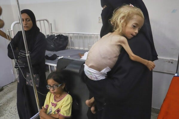 Islam Qudeih holds her severely malnourished shirtless, 2-year-old daughter, Shamm, at Nasser Hospital in Khan Younis, southern Gaza Strip, Saturday, Aug. 9, 2025. (AP Photo/Mariam Dagga, File)