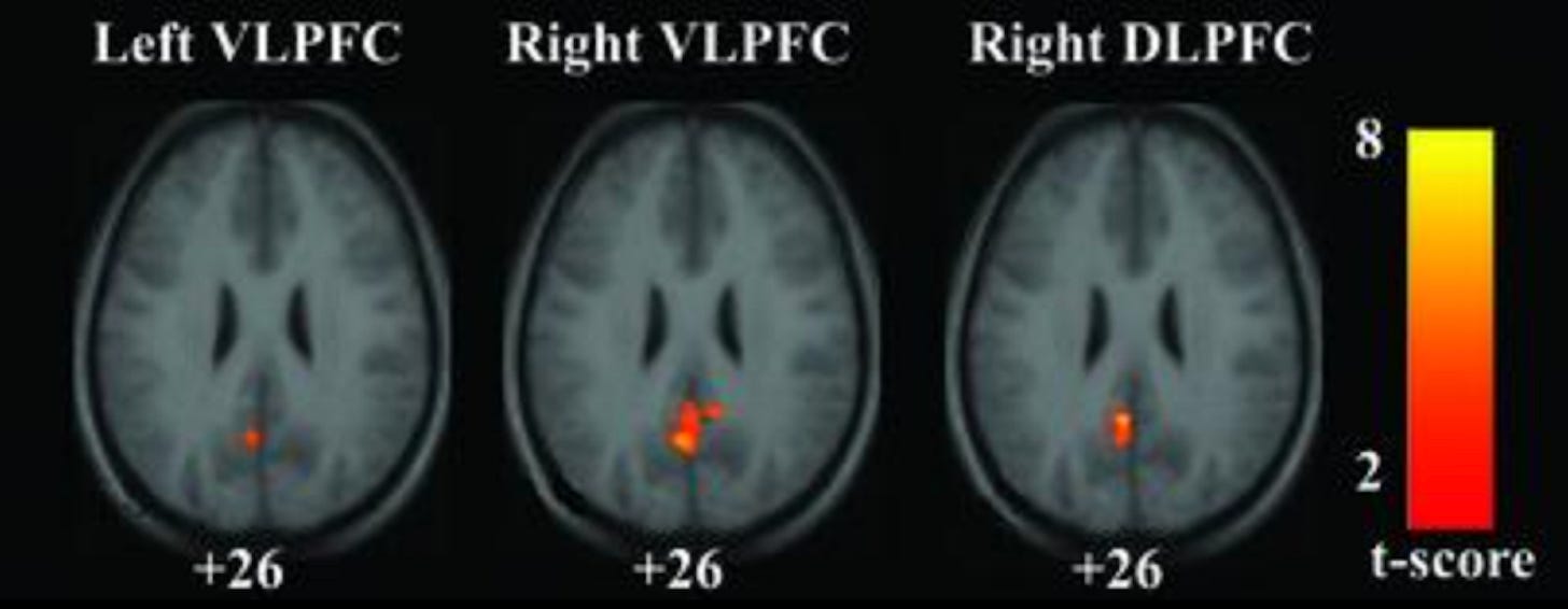 Figure 5. [Greicius et al. (2003)] “Connectivity maps showing regions inversely correlated with the left VLPFC, the right VLPFC, and the right DLPFC. In each case, the only significant cluster was in the PCC.”