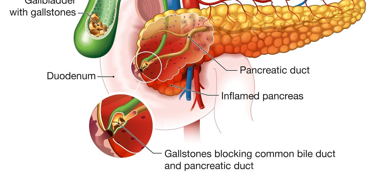 Covid19 Jab Pancreas Damage link to Endotoxin