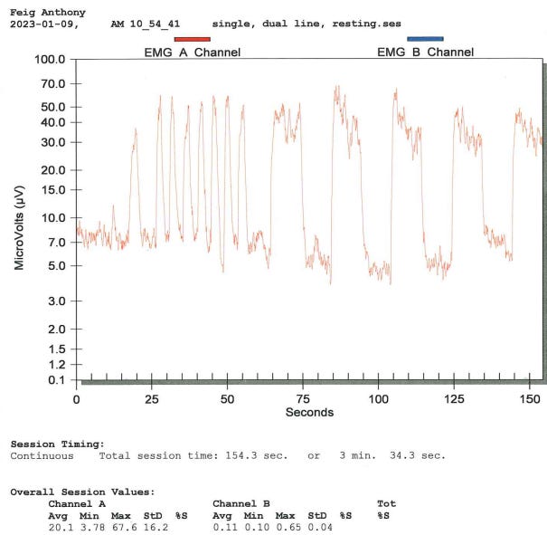 A chart showing electrical strength of pelvic floor muscle contractions over a span of three minutes