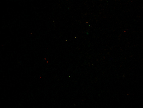 photos on the right and left are microclots.  they were fluorescent green blobs scattered against a dark background.  the middle picture is hyperactivated platelets - they are much smaller, bright red and yellow dots scattered against a black background
