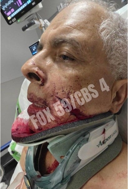 Mark Sanchez's alleged victim fights back in court