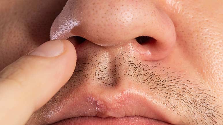 nose picking alzheimer’s and dementia risk