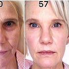 How does she look so good? Ask Cindy from Beyond50Skin!