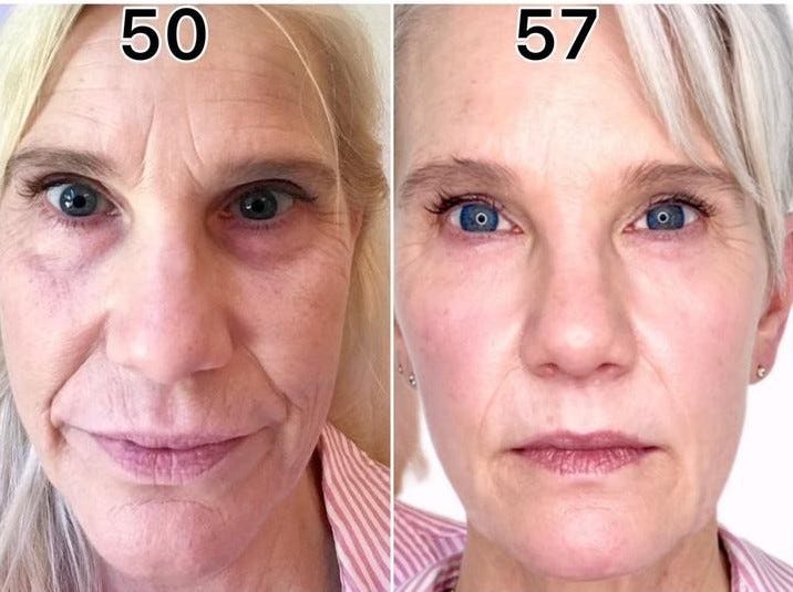 before and after photo of Cindy Sterling