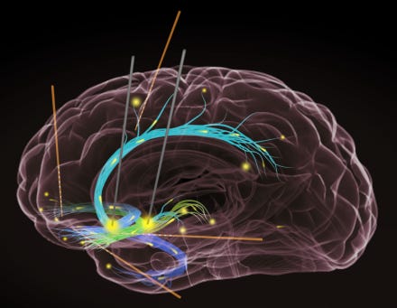 Dr Jack Kruse on MKULTRA, SRI and the BRAIN Initiative 