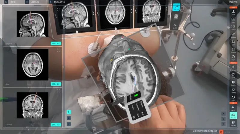 doktor yardımcısı Medivis SurgicalAR doktor yardımcısı Medivis SurgicalAR