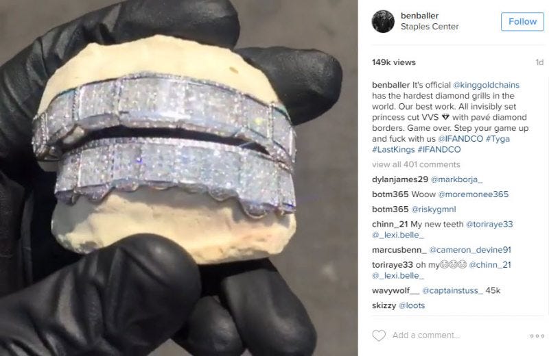 tyga diamond crusted grill 2016 gossip tyga diamond crusted grill 2016 gossip