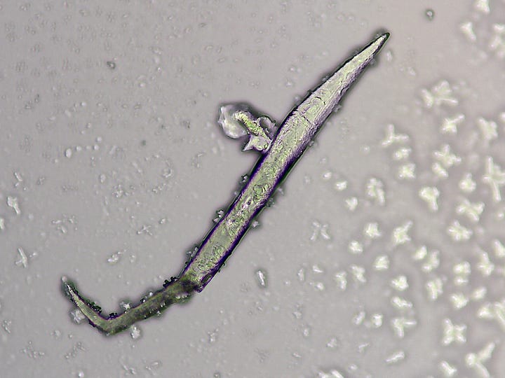 More 'Things' in urine samples