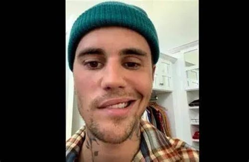 cranial nerve vii justine bieber
