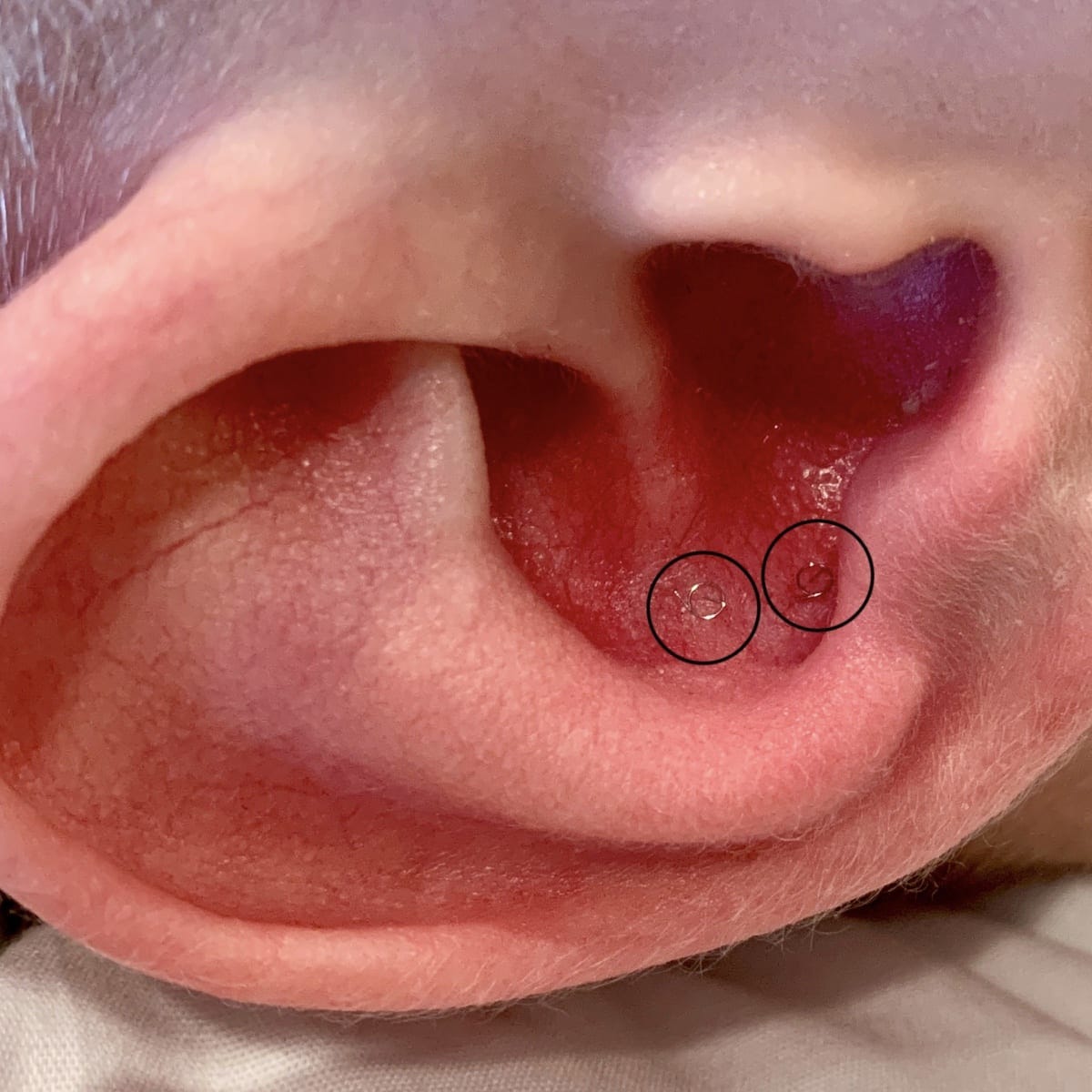 ALLERGY ACUPUNCTURE | Live Oak Acupuncture