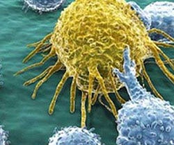 cancer stocks to watch