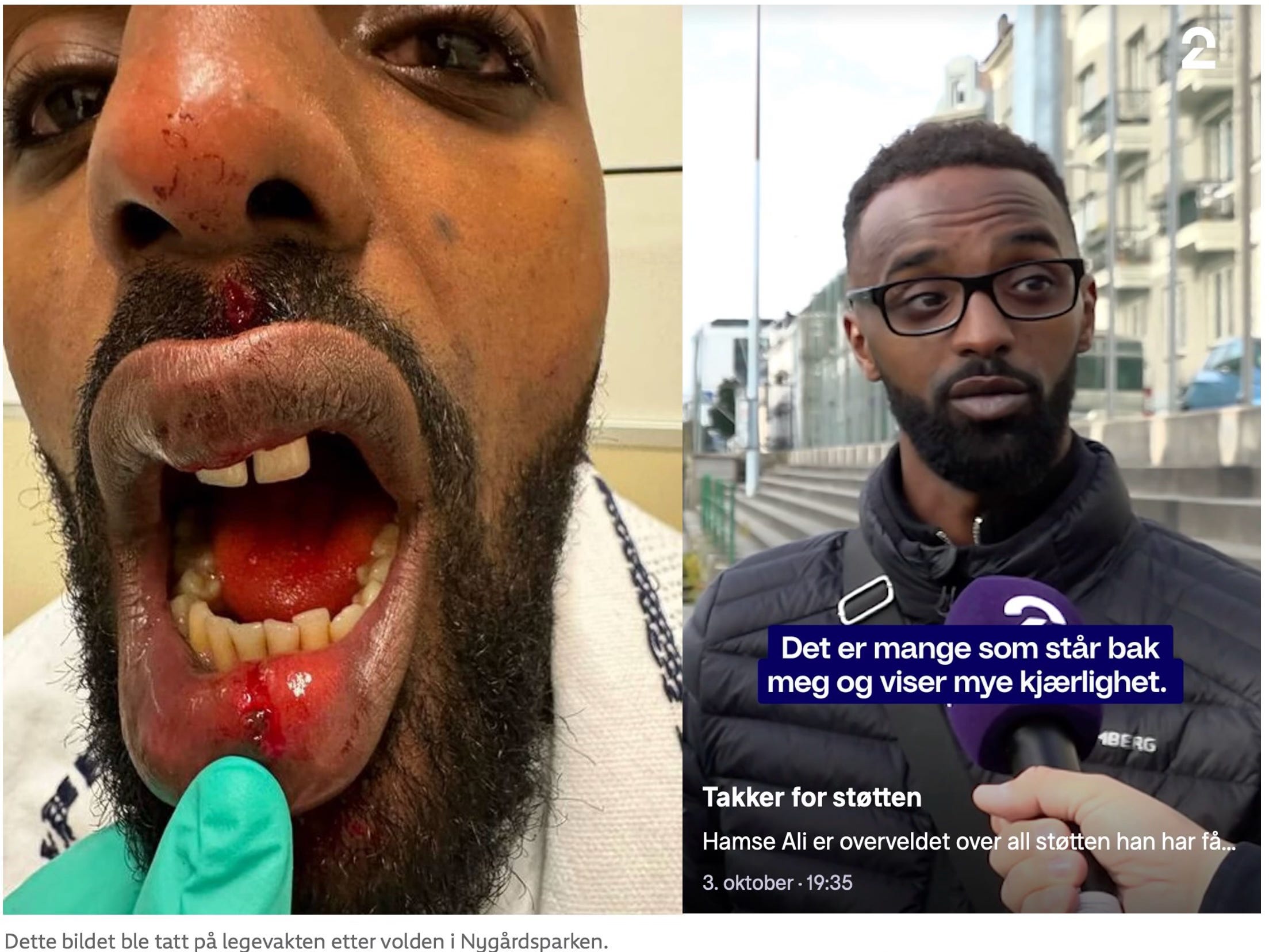 i i7L\u003dr s avoF r Every]Eeek Reds H*lt Propaganala For Oviedo Eleven day.  nnossa UT dw ' Hurricane-Nne Laye, image size:2207x1655