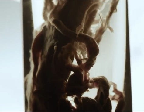 These wormlike blood clots are what develops form self-assembling nanoparticles in the COVID Jabs