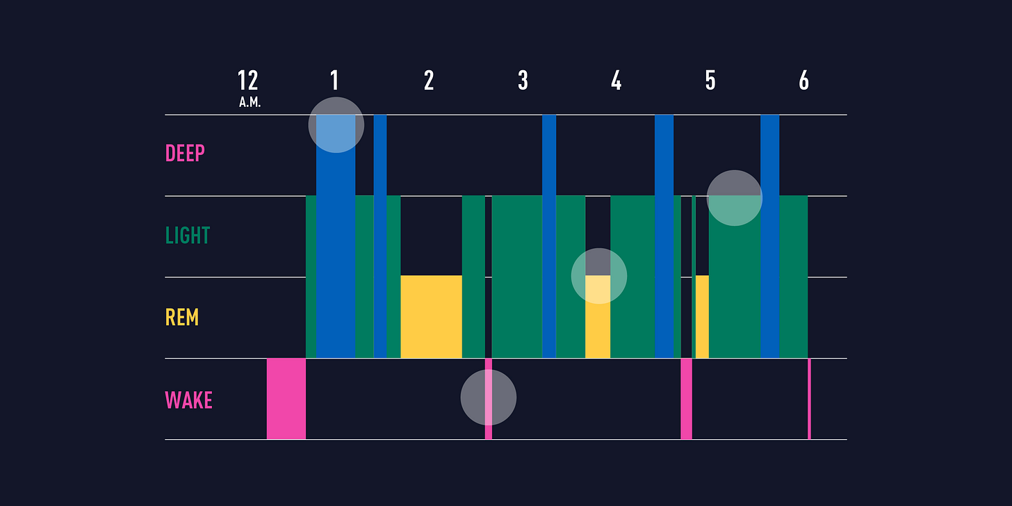 Hypnograms: How To Read A Hypnogram And What It Means
