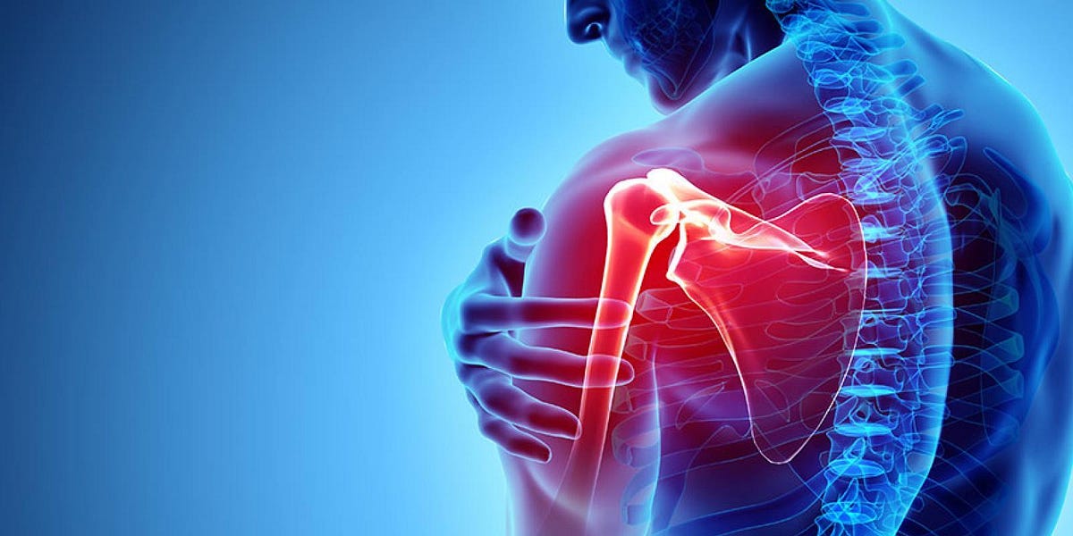 Shoulder Impingement Syndrome: Real, or Yet Another Myth?