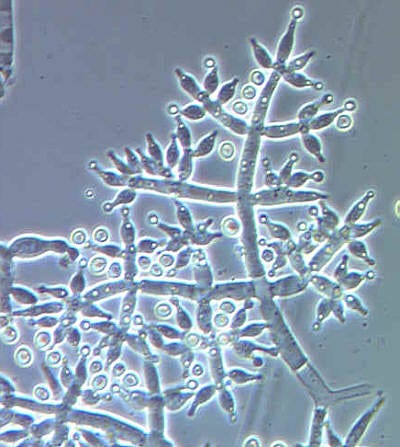 A close-up of a microscopic view of a plant
AI-generated content may be incorrect. A close-up of a microscopic view of a plant
AI-generated content may be incorrect.