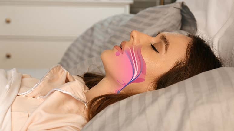 sleep apnea cognitive decline