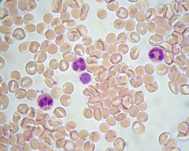 Globuli Rossi E Globuli Bianchi, Osservati Al Microscopio Ottico Con Ingrandimento 1000x Immagine Stock - Immagine: 107274319 Globuli Rossi E Globuli Bianchi, Osservati Al Microscopio Ottico Con Ingrandimento 1000x Immagine Stock - Immagine: 107274319