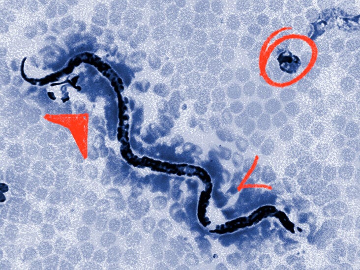 The importancec of rugular parasite cleanses
