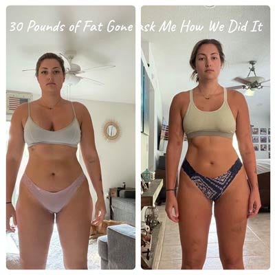 Before and After Photos of Vive Ageless Weight Loss Center