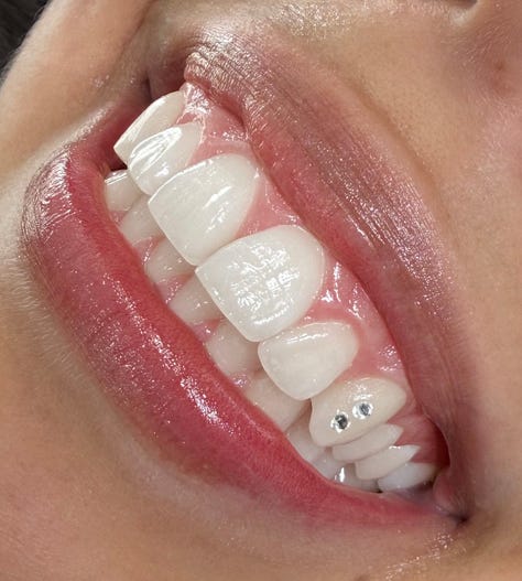 tooth gems italy milan kola payer