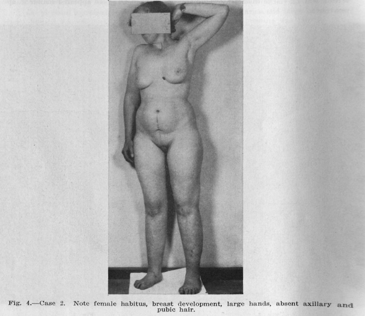 A person standing with her head over her face

AI-generated content may be incorrect.