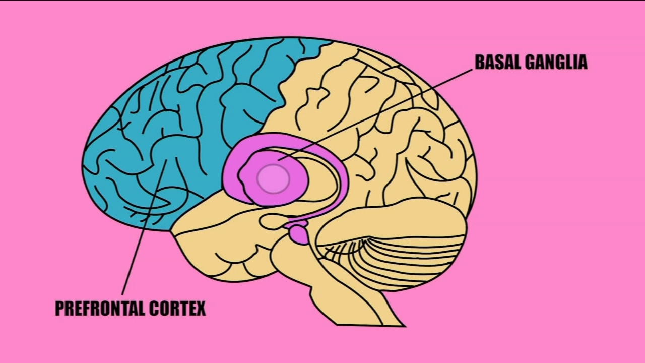 C-REM: Improve Your Gait And Your Brain - ABC30 Fresno