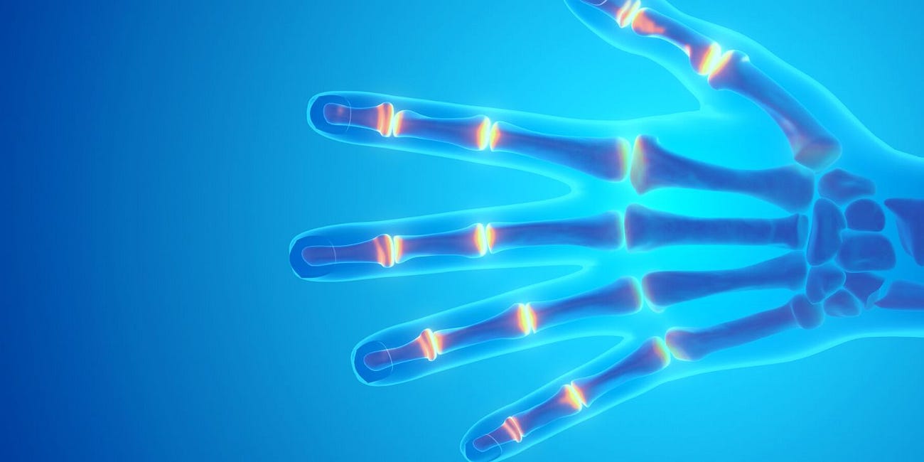 Autoimmune Disease, Rheumatoid Arthritis, Neurological Complications Linked to COVID Vaccine: Journal 'Current Medical Research and Opinion'