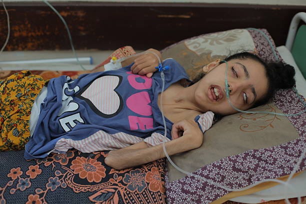 Hibatullah Hani al-Hazin receives treatment and remains in critical condition due to severe malnutrition and bone deterioration at Al-Aqsa Martyrs...