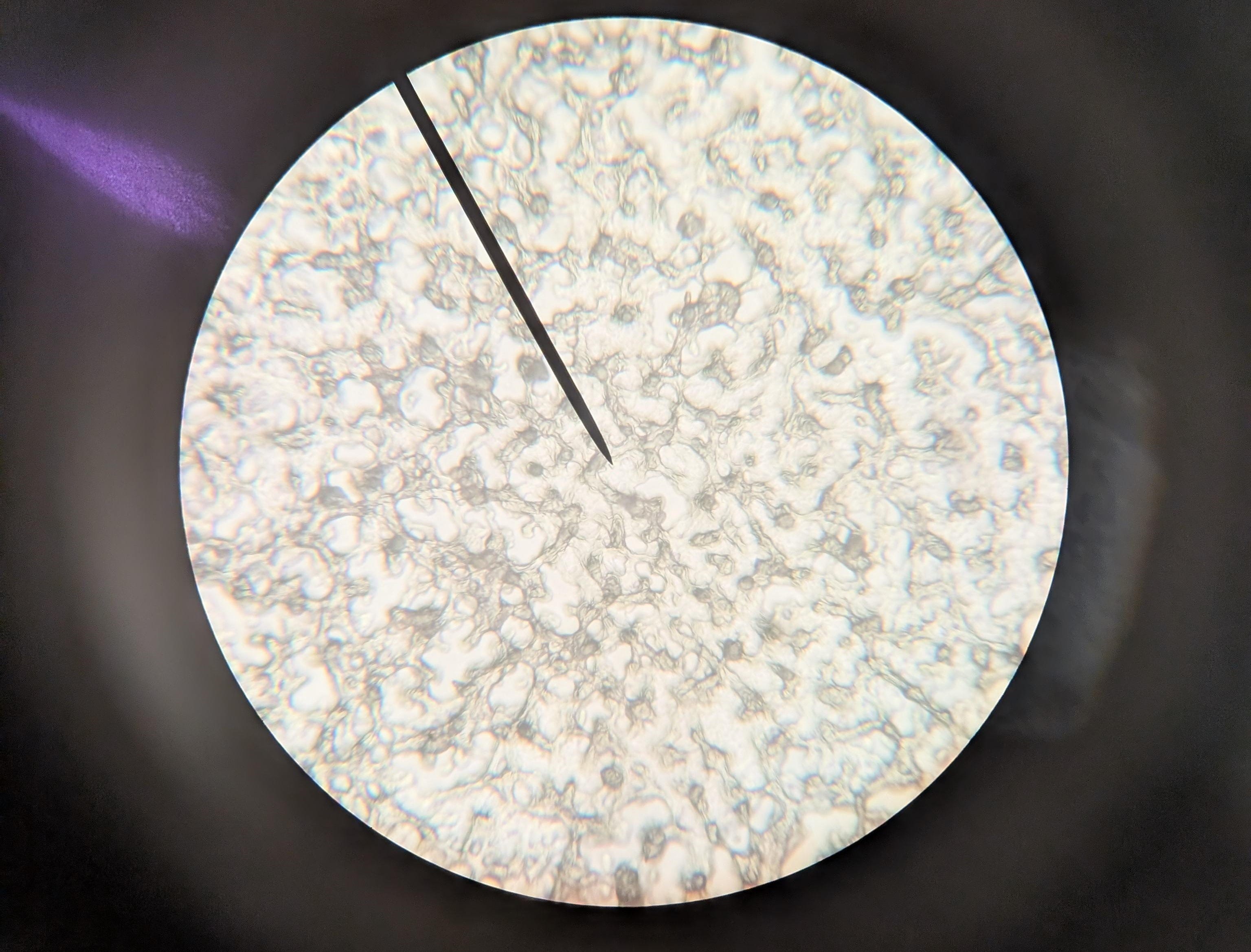 What do spores look like?