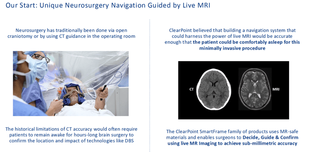 Neurosurgery Navigation