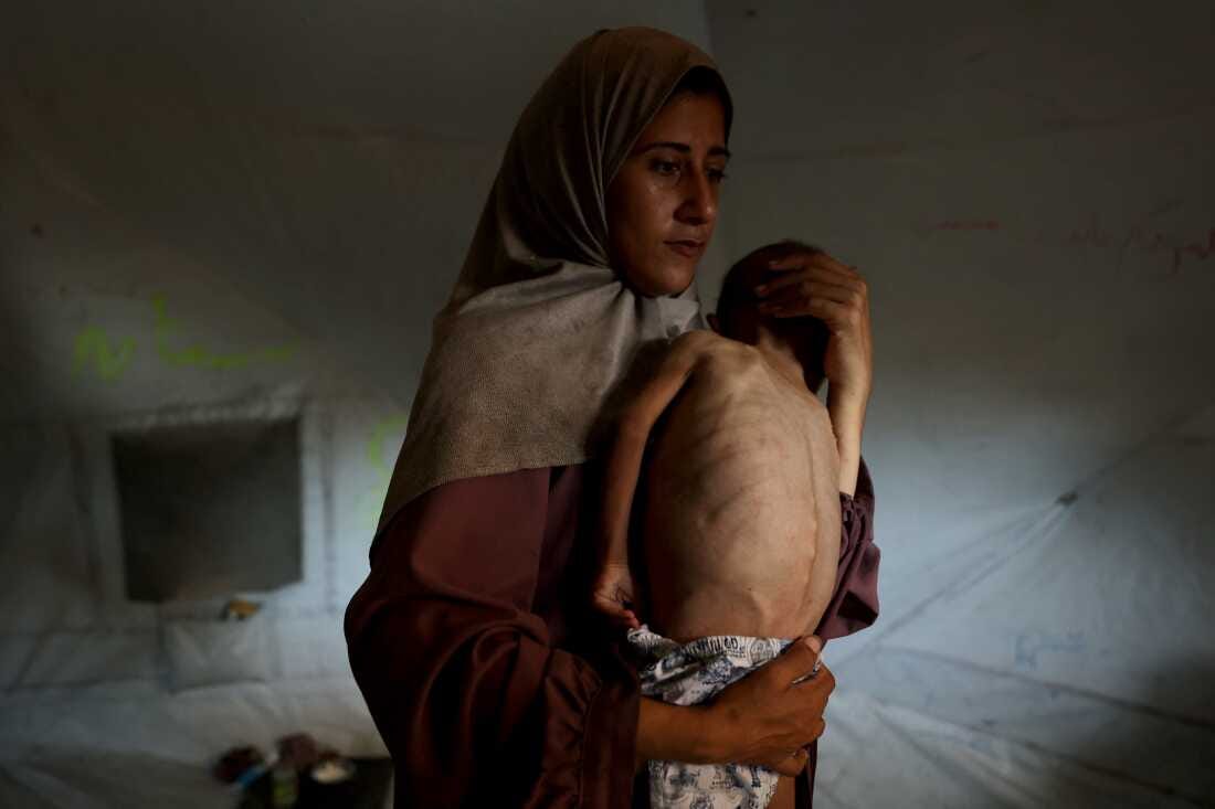 4 things to know about Gaza right now amid warnings of 'mass starvation'  risk : NPR