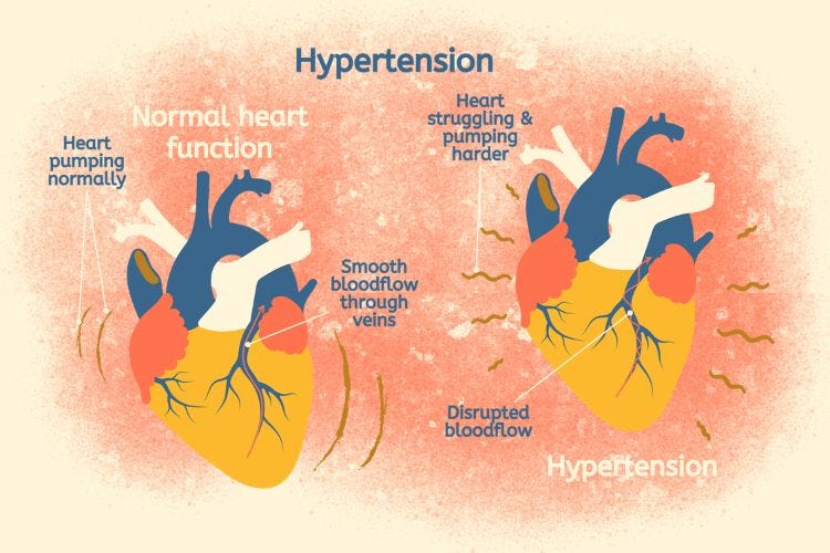 Hypertension