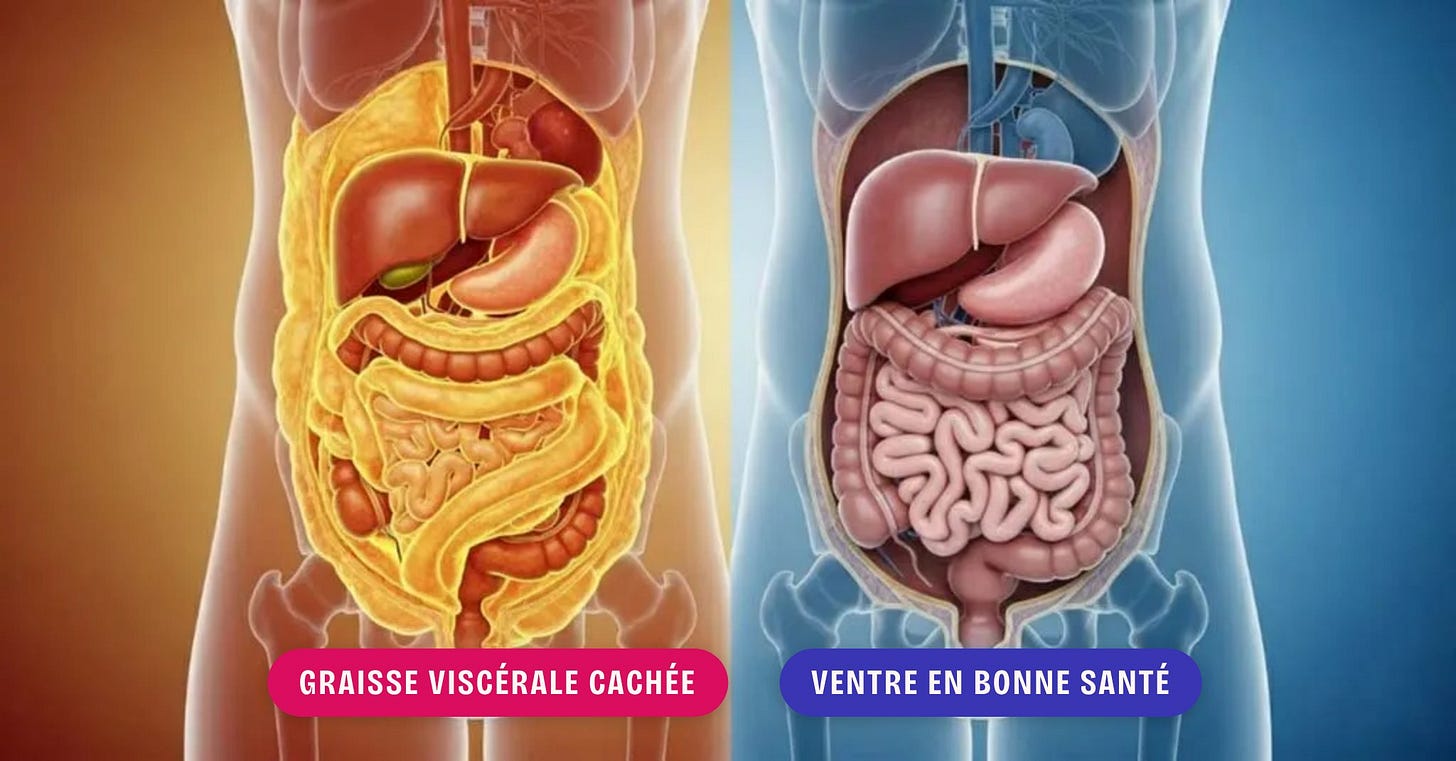 Illustration : à gauche, des organes entourés de graisse viscérale ; à droite, un ventre sans excès de graisse viscérale.