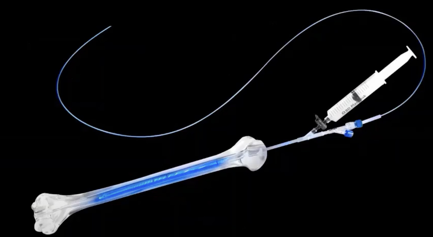 A close-up of a medical device
AI-generated content may be incorrect. A close-up of a medical device
AI-generated content may be incorrect.