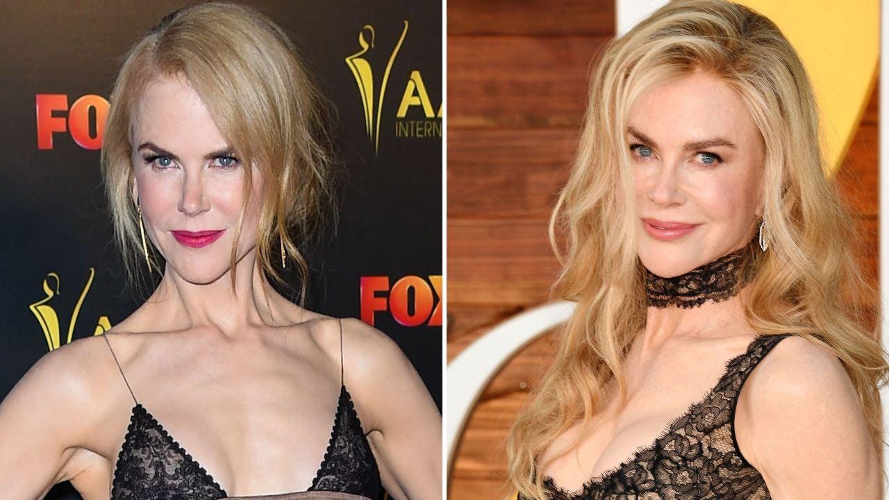 Photo of Nicole Kidman Photo of Nicole Kidman