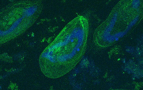 Three images taken with expansion microscopy showing the structural organisation of cells.