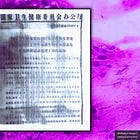 No U.S. Agency Ever Verified the Lung Sample the Chinese Gov’t Built the SARS-CoV-2 Genetic Sequence From