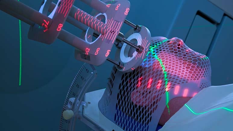radiation treatment