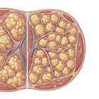 Can Lipedema Fat Actually Shrink With Weight Loss?