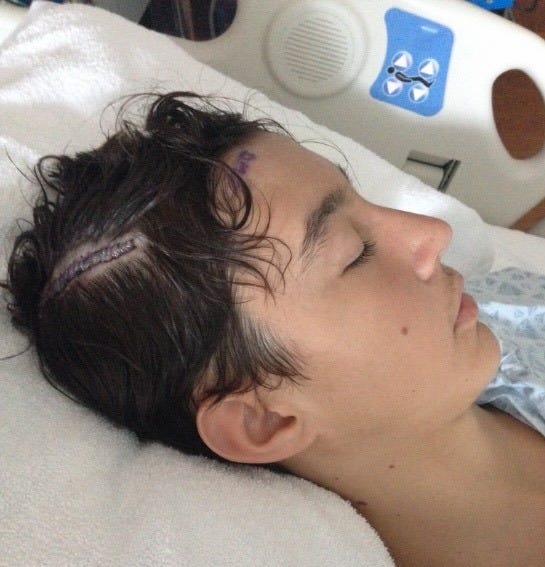 Joseph Lanzi after neurosurgery Joseph Lanzi after neurosurgery