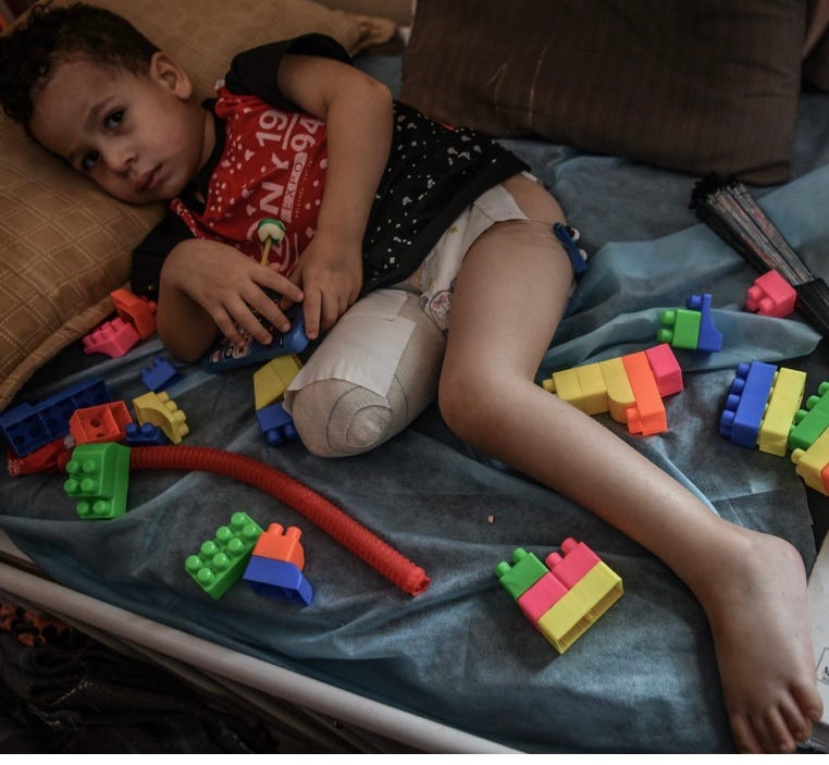 9,000 Palestinian Children's Limbs Amputated Amid Ruthless Israeli Bombings  - S2Jnews