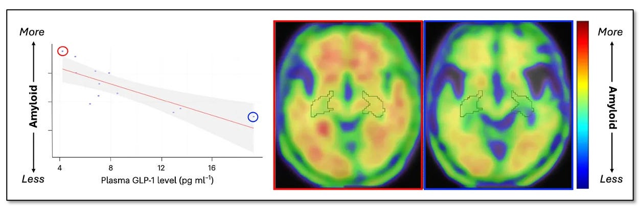 glp 1 alzheimer's GLP-1s for Alzheimer's. Here's What the Data Say